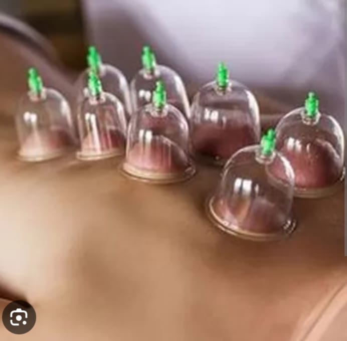 Wet & Dry Cupping Therapy